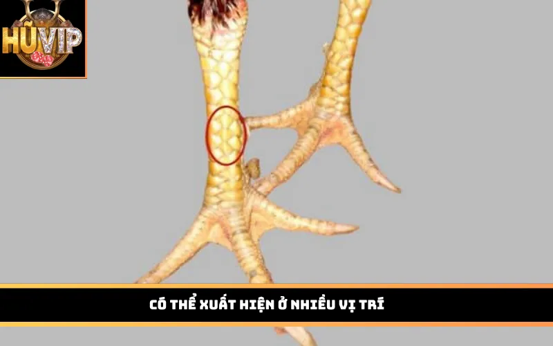 Có thể xuất hiện ở nhiều vị trí